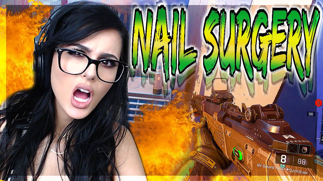 NAIL SURGERY! | Black Ops 3 “MX Garand” Gameplay