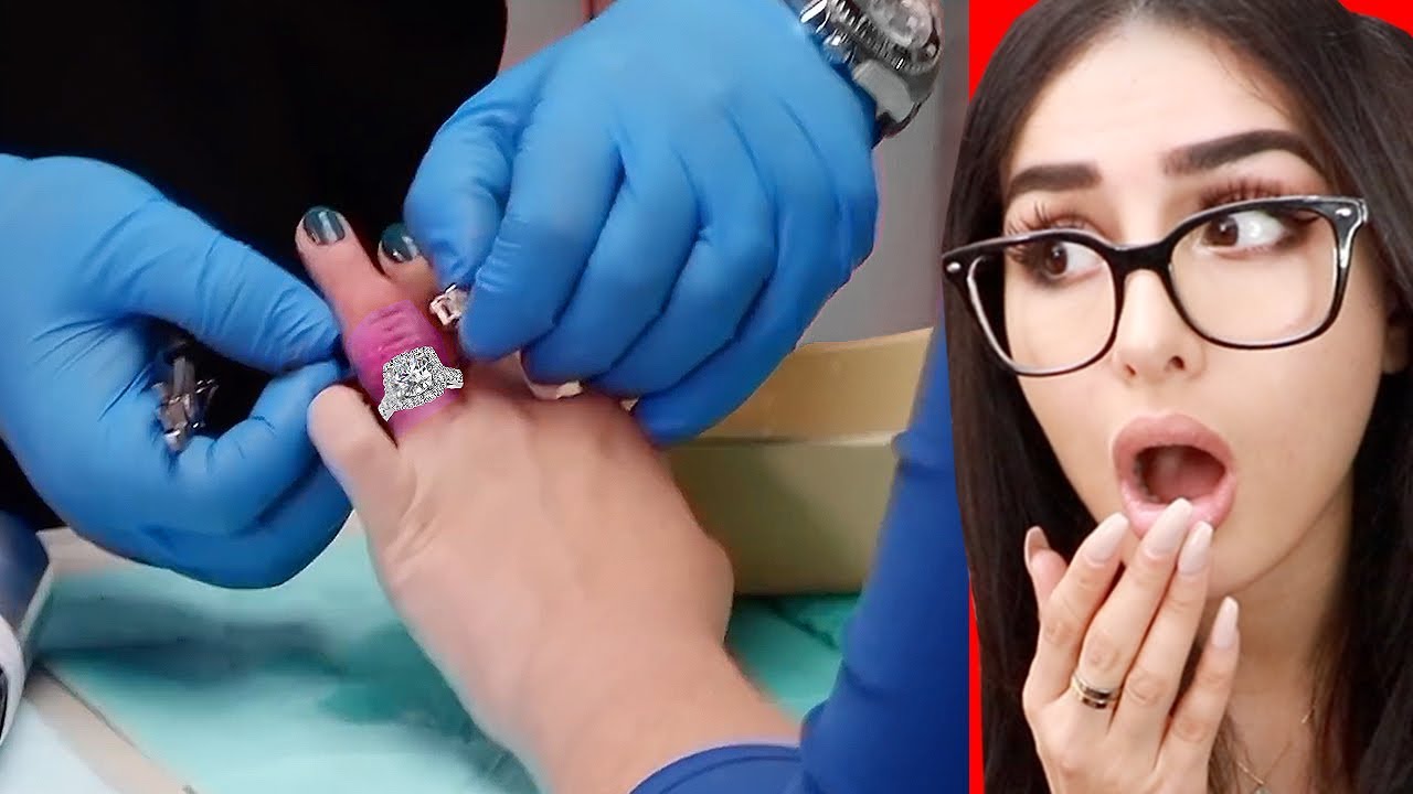 Expensive Ring Gets STUCK On Woman’s Finger