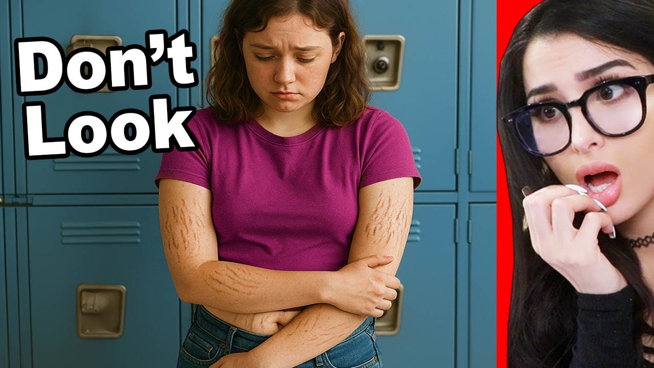 Girl Gets Bullied For Having Stretchmarks