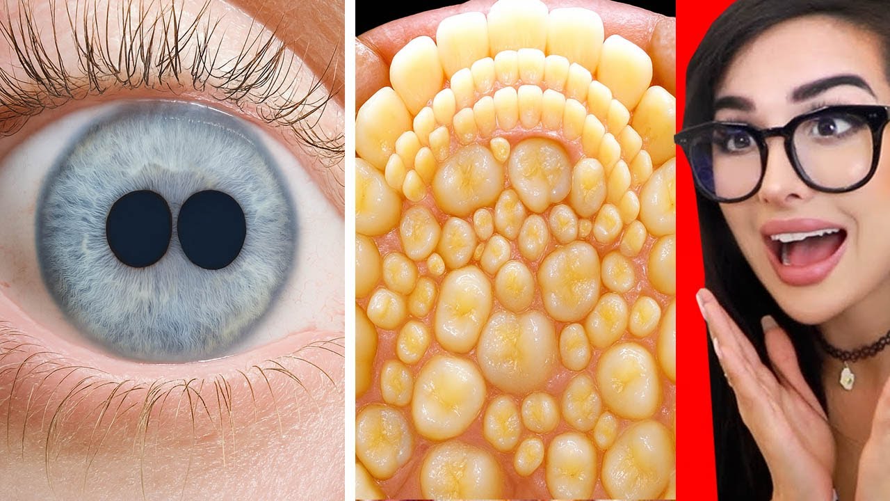 People With Unique Features